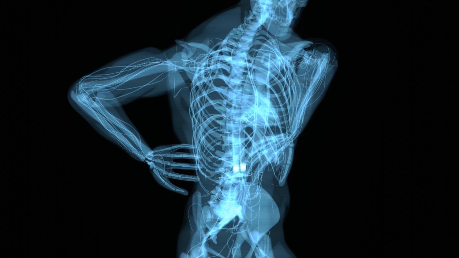 Back Pain