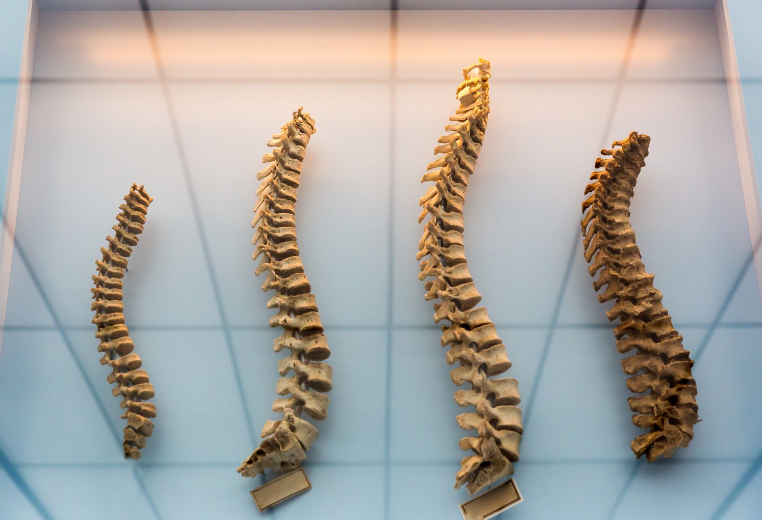 Spine